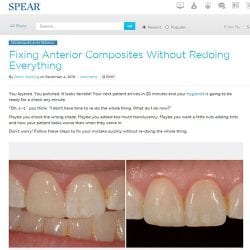 Fixing Anterior Composites Without Redoing Everything