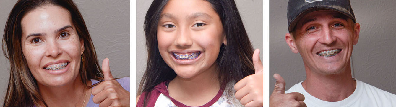 Braces Patients of Complete Family & Aesthetic Dentistry